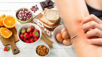 Kas yra maisto alergija? Kam pasireiškia maisto alergija ir kokie simptomai?