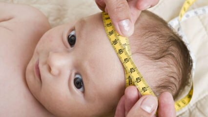 Kaip išmatuoti kūdikio galvos apimtį? Kaip ištaisyti kūdikio galvos aštrumą?