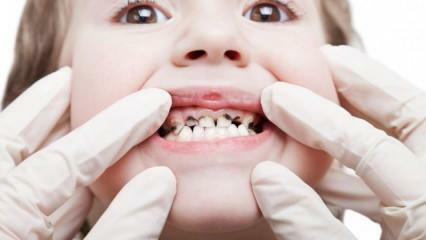 Pasirūpinkite savo vaiko dantų priežiūra semestro metu!