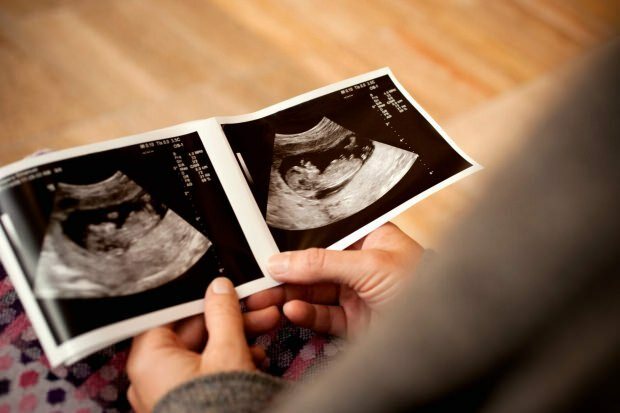 Kada bus nustatyta kūdikio lytis?