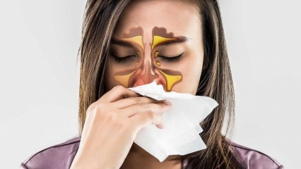 Kas yra alergija? Kokie yra alerginio rinito simptomai? Kiek yra alergijos rūšių? 