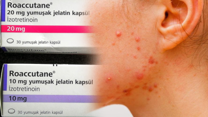 Kas yra Roaccutane? Kaip naudoti? Kaip atsikratyti Roaccutane šalutinio poveikio?