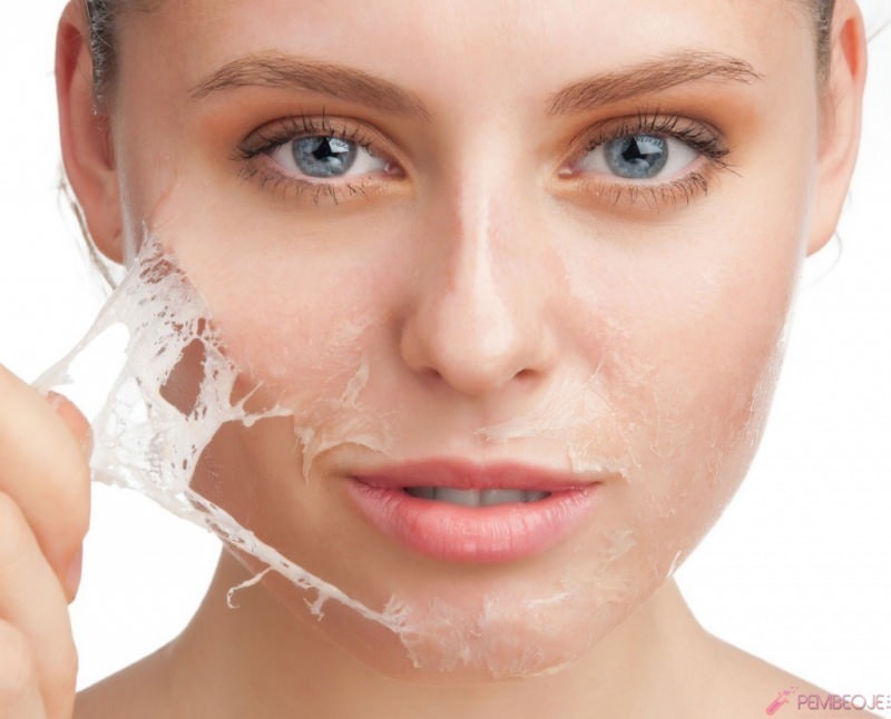 Kuo naudingas odos lupimasis ir kaip odos lupimasis? Namų priemonė nuo odos lupimo