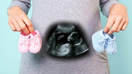 Ar kūdikio lytis bus nustatyta pirmąjį nėštumo trimestrą?