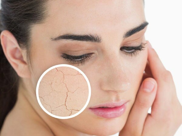 Kodėl oda sausėja? Ką daryti ant sausos odos? Veiksmingiausios sausos odos priežiūros rekomendacijos