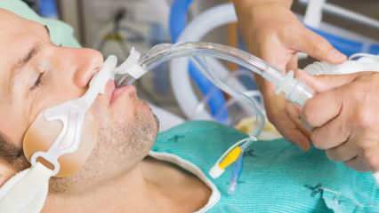 Kas yra intubacija, kurią pasakė Fahrettinas Koca? Ką reiškia intubuoti pacientą? Ar intubuotas pacientas pasveiks?