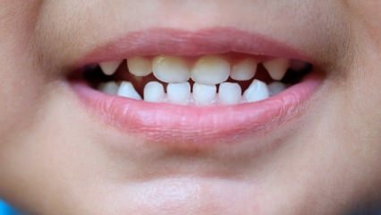 Kaip išmokyti vaikus dantų priežiūros?