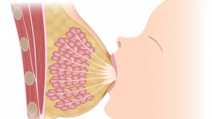 Kas yra mastitas (krūties uždegimas)? Mastito simptomai ir gydymas žindymo metu