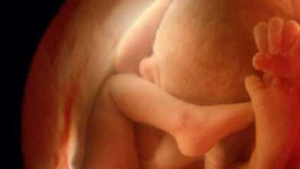 Nerodyti kūdikio lyties ultragarsu! Kaip berniukai ir mergaitės atrodo ultragarsu?
