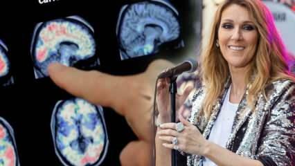 Kas yra standaus žmogaus sindromas? Celine Dion