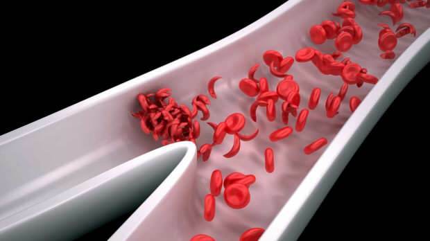dirglumas ir nuovargis didėja mažėjant kraujo ląstelėms