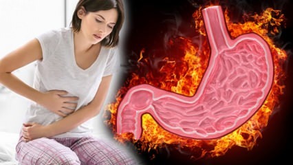 Kas yra gastritas? Kokie yra gastrito simptomai ir ar jie gydomi? Kuo naudingas gastritas?
