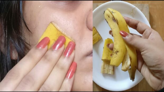 Ar banano žievelė naudinga odai? Kaip bananas naudojamas odos priežiūrai?
