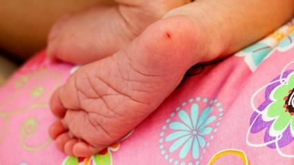 Kodėl kūdikiams imamas kulno kraujas? Reikalavimai kūdikių kraujo tyrimams