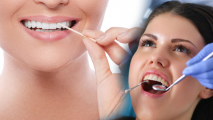 Kaip saugoma burnos ir dantų sveikata? Į ką reikia atsižvelgti valant dantis?