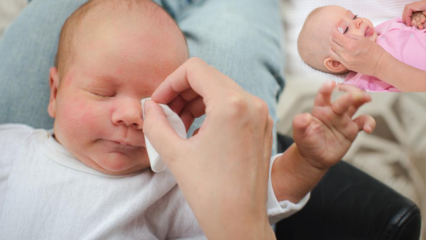 Kaip pašalinti burbuliukus kūdikiams? Sukelia kūdikiams akių išsišakojimą? Burr masažas su motinos pienu