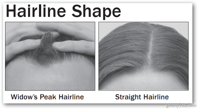 Plaukų linijos forma