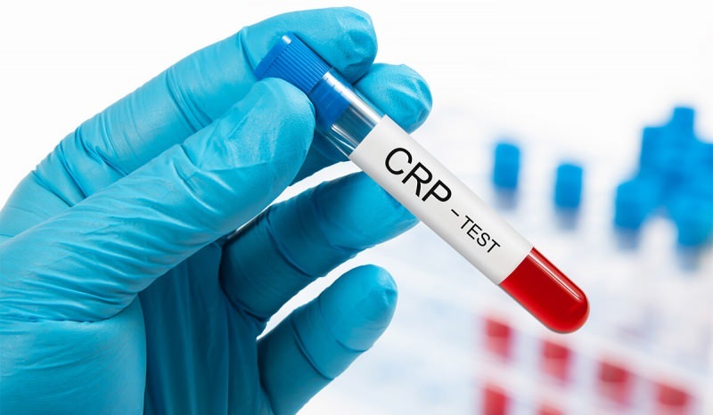 Kodėl kraujyje padidėja CRP? Kas yra CRP? Kaip sumažinti CRP?