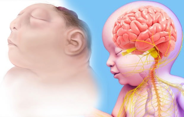 Ar gyvena kūdikis nuo anencefalijos? Anencefalinė diagnozė