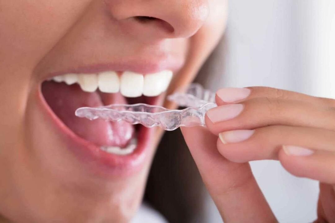 Kaip išvengti dantų griežimo? Kas sukelia dantų griežimą (bruksizmą) miegant?