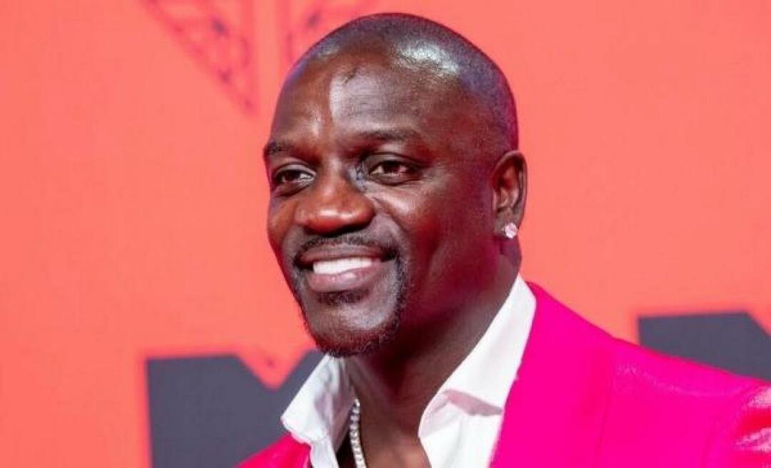 Amerikiečių dainininkė Akon taip pat pirmenybę teikė Turkijai plaukų persodinimui! Štai kaina, kurią jis sumokėjo...