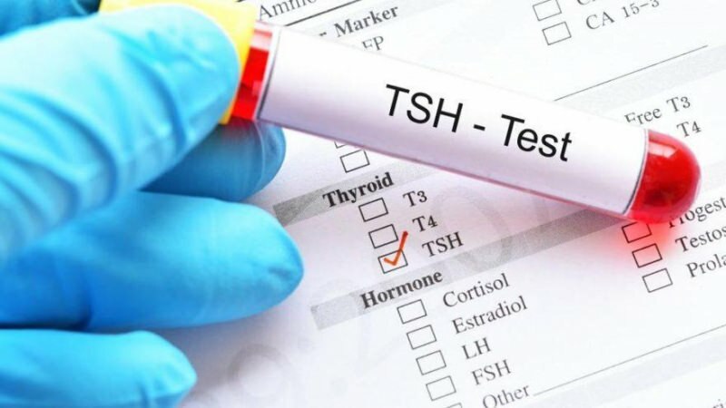 tsh testas yra hormonu testas