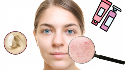 Kaip praeina odos dėmė? 4 natūraliausi odos šalinimo būdai