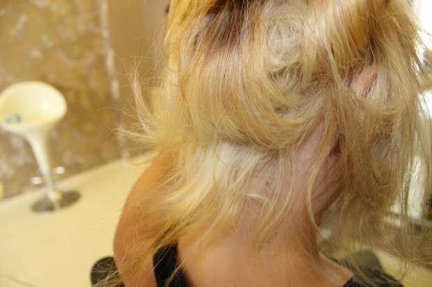 Kas daroma degantiems plaukams iš vidurio? Kaip reikia prižiūrėti apdorotus plaukus?