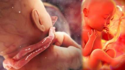 Kas yra laido įsipainiojimas? Virvelės įstrigimas aplink kūdikio kaklą motinos įsčiose