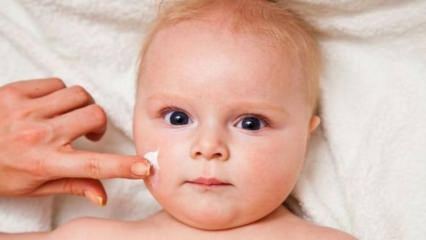 Odos priežiūros patarimai kūdikiams! Kokios yra kūdikių odos problemos?