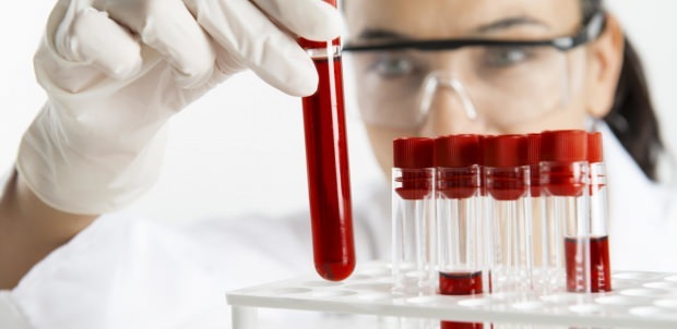 hemoglabino lygis yra tikrinamas atliekant kraujo tyrimą