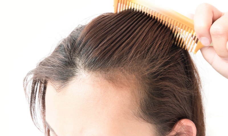 plaukų slinkimo sprendimai po gimdymo! Kuo naudingas plaukų slinkimas?