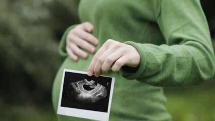 Kada kūdikio lytis yra ankstyviausia ir aiški? Kas lemia lytį?