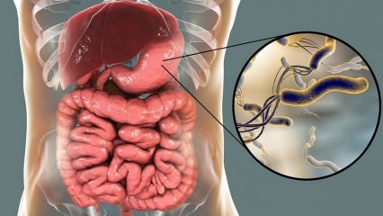 Kas yra Helicobacter Pylori (skrandžio mikrobas)? Helicobacter Pylori sukeltos ligos ...