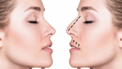 Kokie yra nosies mažinimo būdai namuose? Nosies susitraukimo pratimai
