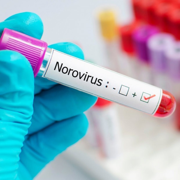 Kas yra norovirusas ir kokias ligas sukelia