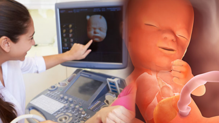 Kuris organas pirmiausia išsivysto kūdikiams? Kūdikio vystymasis kiekvieną savaitę