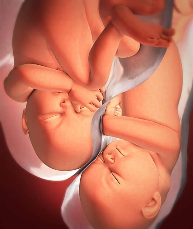 Kokie yra dvynių nėštumo simptomai?