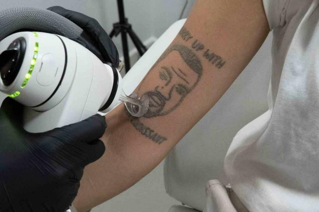 Milžiniška paslauga tiems, kuriems nepatinka Kanye West! Galimybė nemokamai pašalinti jo tatuiruotę sukėlė netvarką