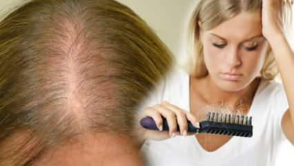 Koks yra efektyviausias būdas nuo plaukų slinkimo? Kaukių receptai, stabdantys plaukų slinkimą