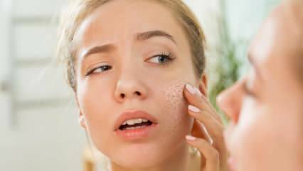 Kodėl oda sausėja? Ką daryti ant sausos odos? Veiksmingiausios sausos odos priežiūros rekomendacijos