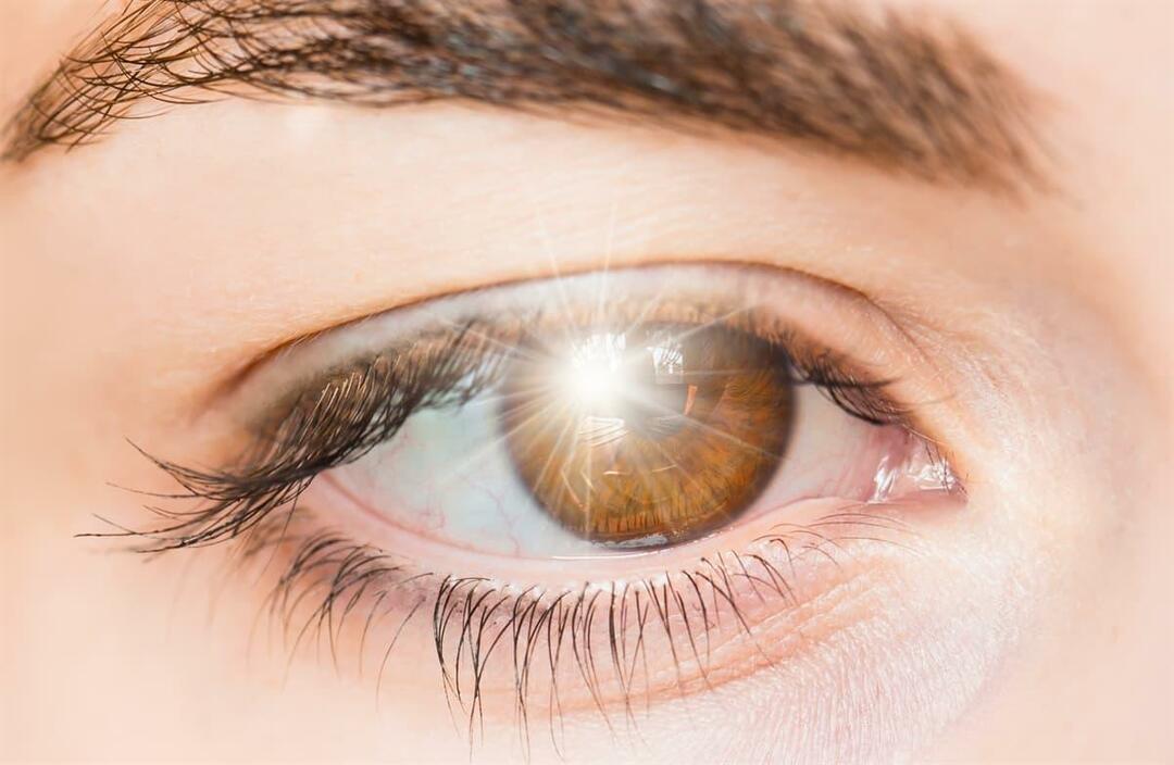 Kas sukelia šviesos blyksnius akyje ir kaip tai gydyti?