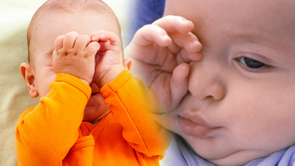 Natūralūs sprendimai akių deginimui kūdikiams