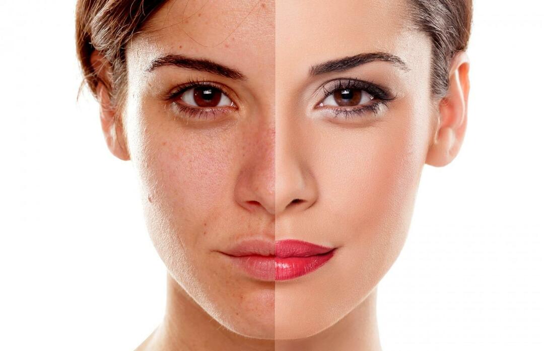 Kaip išvengti, kad oda atrodytų pavargusi? Kaip sumažinti pavargusią odos išvaizdą?
