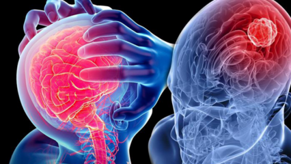 Kas yra smegenėlių (stuburo smegenų) degeneracija? Kokie yra smegenų (nugaros smegenų) simptomai?