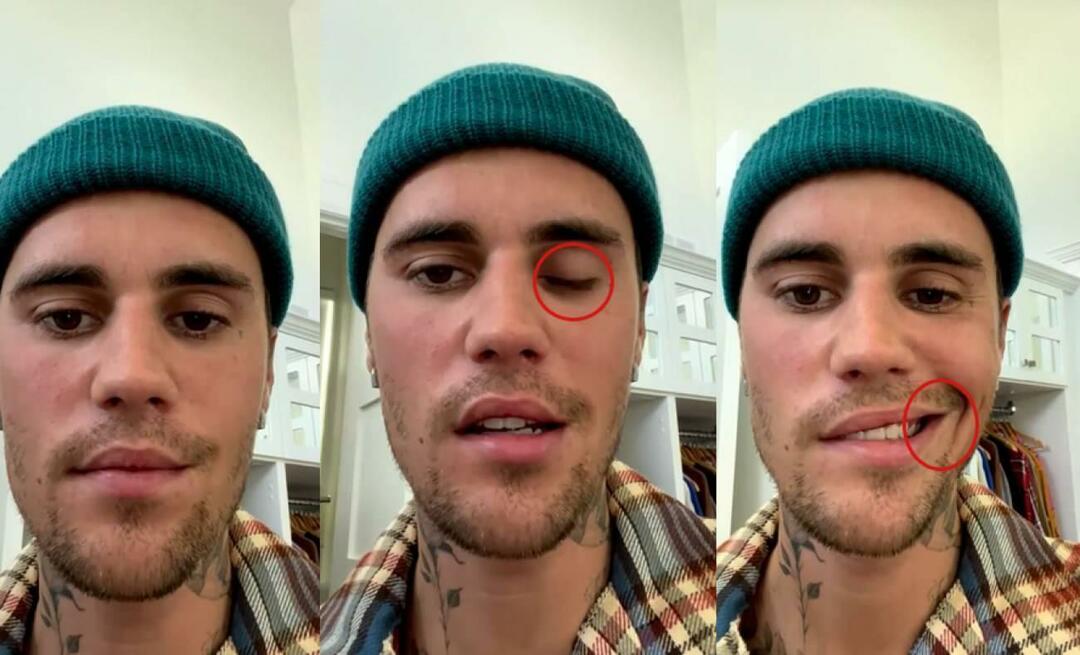 Justinas Bieberis patyrė veido paralyžių! Garsioji žvaigždė negali dar kartą leistis į pasaulinį turą