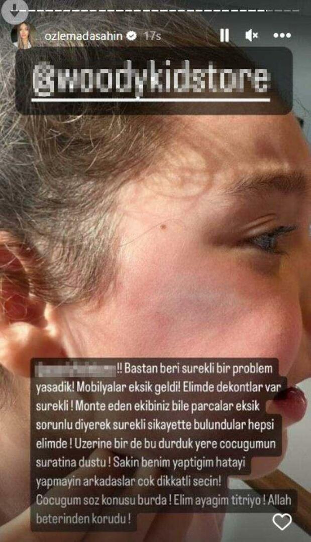 Spintos durys užkrito Berkay Şahin dukrai ant veido