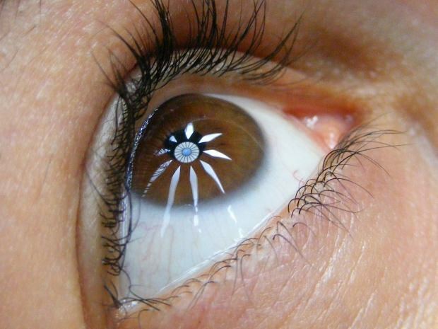 Kas yra naktinio aklumo (vištienos juodos spalvos) liga? Kokie yra naktinio aklumo simptomai?
