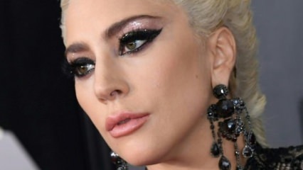 Pasaulinio garso Lady Gaga tampa picos platintoja