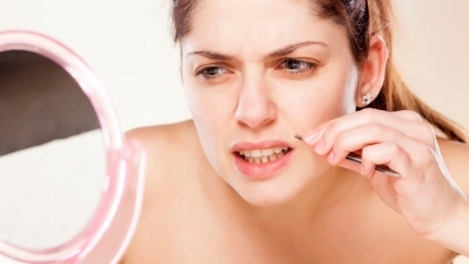 Kaip išvengti ūsų moterims? Kaip sunaikinti ūsus?